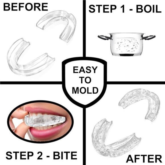 Small Mouth Guard for Women – Comfortable, Custom Fit, Non-Bulky, Moldable - Picture 5 of 7